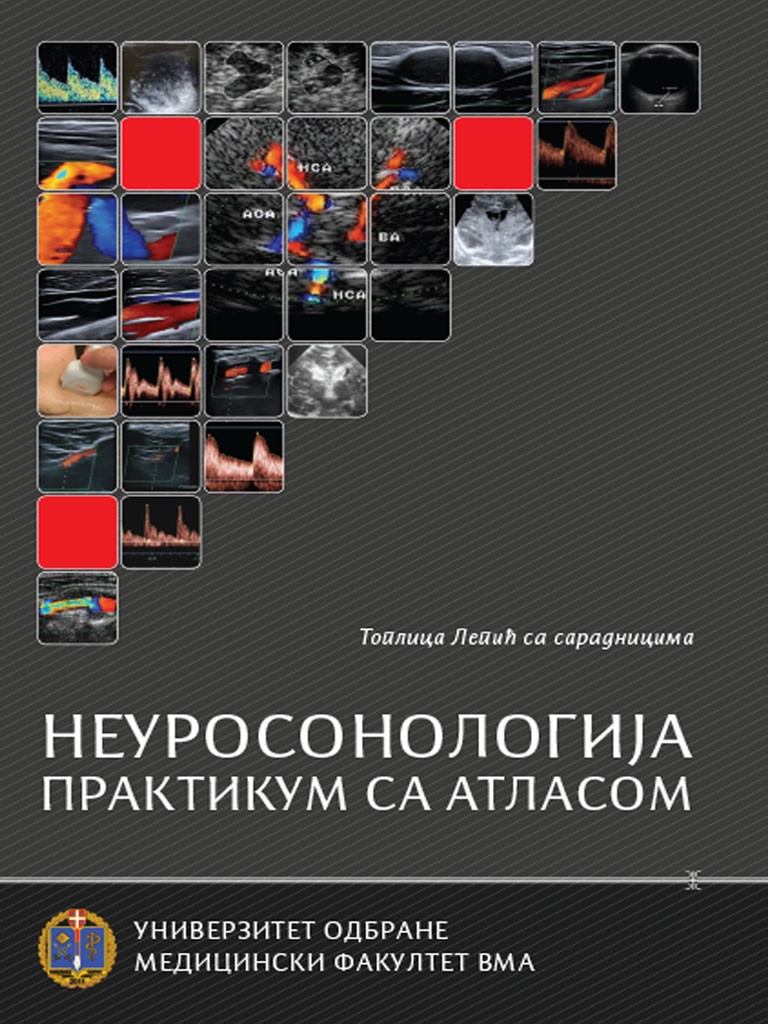 NEUROSONOLOGIJA – PRAKTIKUM SA ATLASOM