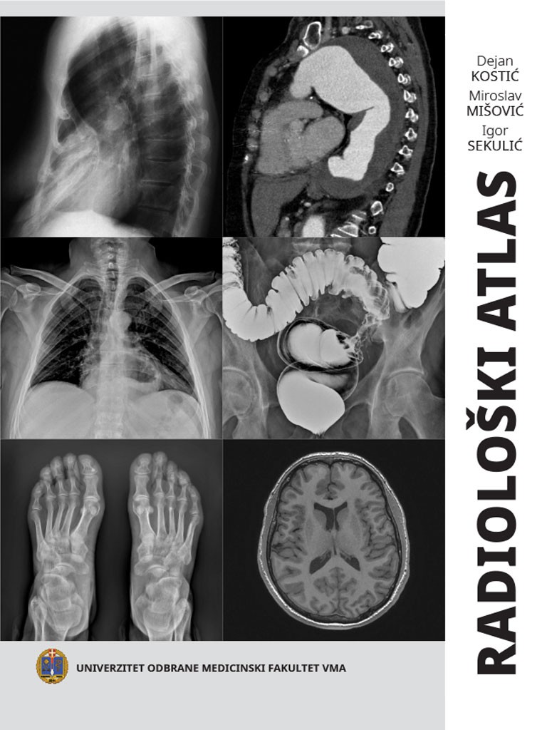 RADIOLOŠKI ATLAS