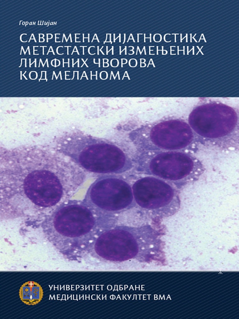 SAVREMENA DIJAGNOSTIKA METASTATSKI IZMENJENIH LIMFNIH ČVOROVA KOD MELANOMA