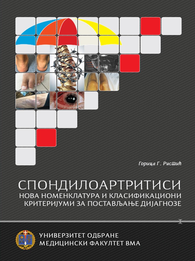 SPONDILOARTRITISI – NOVA NOMENKLATURA I KLASIFIKACIONI KRITERIJUMI ZA BRŽI PUT DO DIJAGNOZE